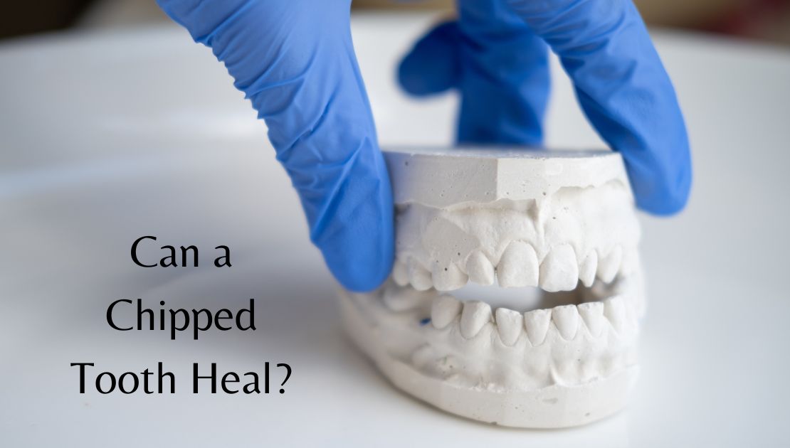 Can a Chipped Tooth Heal?