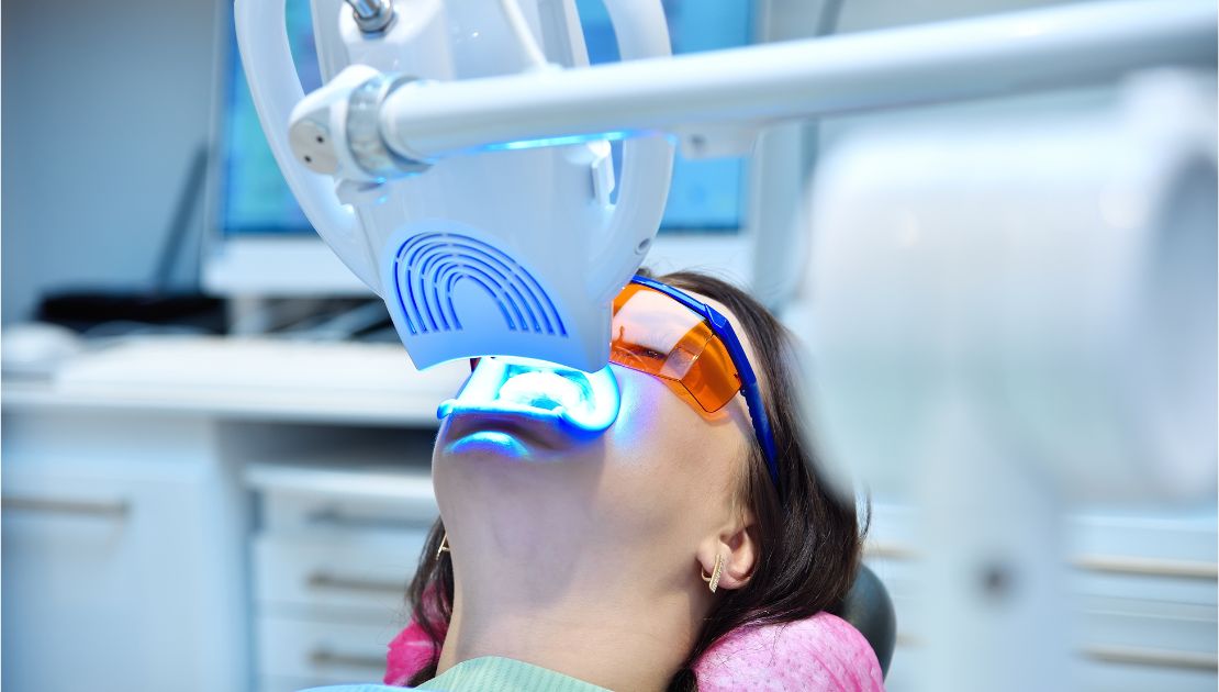Laser Teeth Whitening