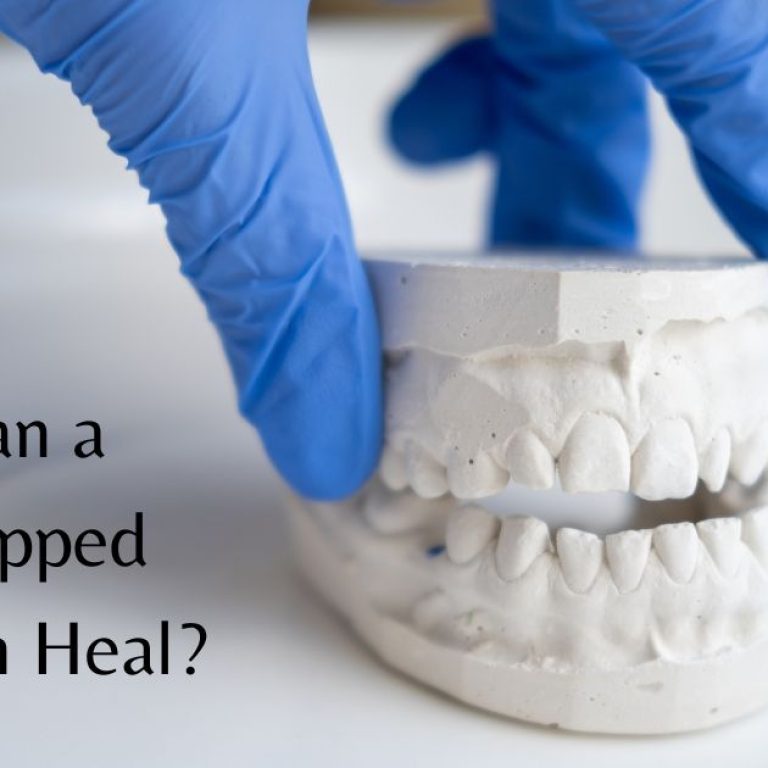 Can a Chipped Tooth Heal?