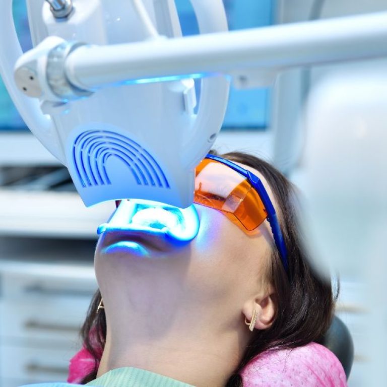 Laser Teeth Whitening
